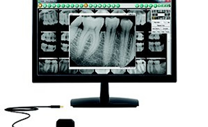 DEXIS Digital Radiograph