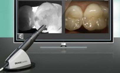 Transillumination Diagnostic