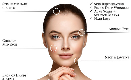 PRP Facial & Hair Treatments